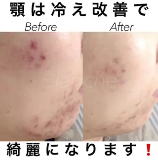 ミディアム カラー パーマ ヘアアレンジ ネイル マツエク・マツパ 都度払い肌質改善 &脱毛Blancheのエステ・リラクイメージ