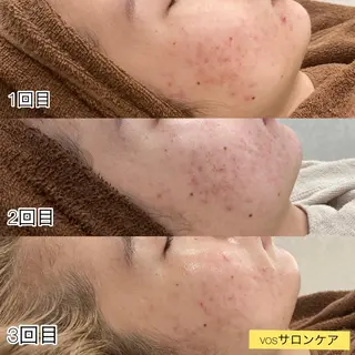 laluna saki...のその他イメージ