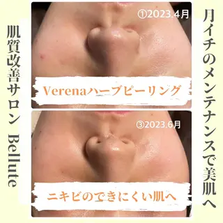 ピーリング専門店 Belluteのエステ・リラクイメージ