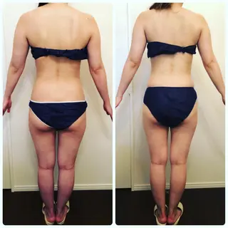 FLEUR大阪・美容 整体・痩身・小顔のエステ・リラクイメージ