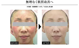 Ganesa Fusion Studio所属・井上 みあのエステ・リラクイメージ