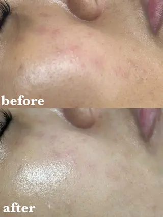 【肌質改善サロン】 リーフィアのエステ・リラクイメージ