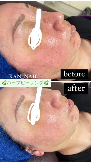 志免町 フェイスシャルエステのエステ・リラクイメージ