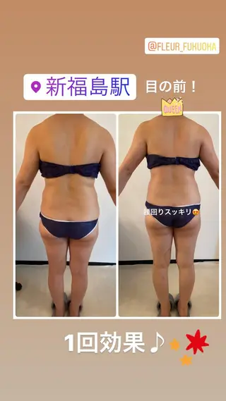 FLEUR大阪・整体 ・ハイフ・痩身・小顔のエステ・リラクイメージ