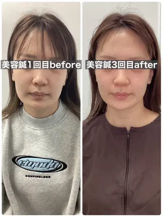 hari salon de off 美容鍼灸×小顔整体【ハリサロンドオフ】所属・美容鍼×小顔整体🤍 ishibashiのエステ・リラクイメージ