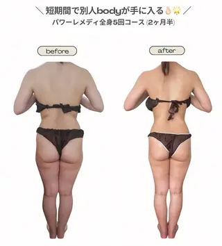 biloop所属・BILOOP ﾋﾞﾙｰﾌﾟのエステ・リラクイメージ