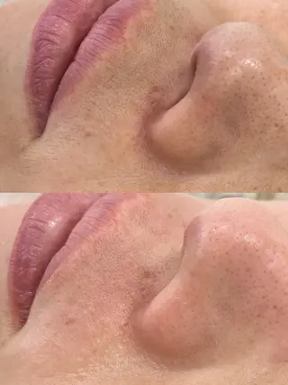 Salon de Galcon 2階(サロンド・ギャルソン)所属・KU TA  \(◡̈)/のエステ・リラクイメージ