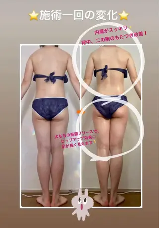 ショート カラー パーマ ヘアアレンジ メンズ キッズ ネイル マツエク・マツパ ‍痩身＆ボディ 結果出し🌟丹野のエステ・リラクイメージ