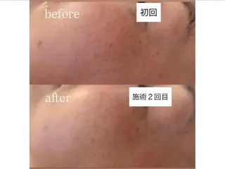 salon＿drop所属・salon dropのエステ・リラクイメージ