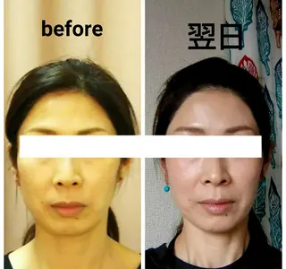 小顔と美肌 まごころエステMatoria所属・小顔 美肌専門 Matoriaのエステ・リラクイメージ