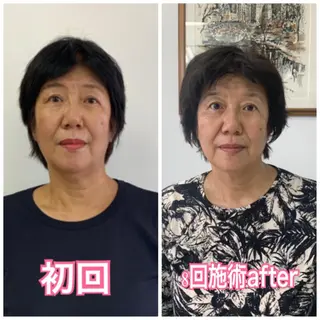 小顔と ヘッドスパのお店のエステ・リラクイメージ