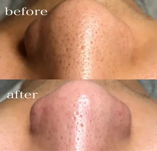 メンズ Petitmaison所属・Petit maisonのネイルデザイン