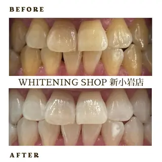 メンズ ホワイトニング ショップ新小岩店のその他イメージ