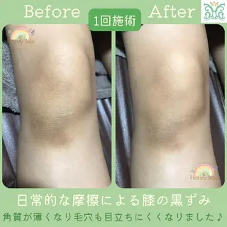 剥離するハーブ🌈 Honey Sideのエステ・リラクイメージ
