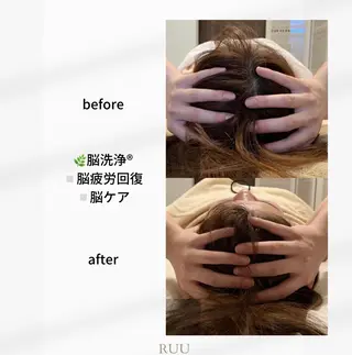 【頭痛、睡眠改善】 salon RUUのエステ・リラクイメージ