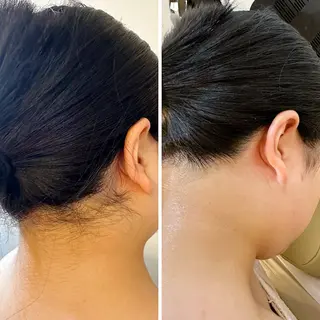 うなじ脱毛/美肌脱毛 LABELのエステ・リラクイメージ