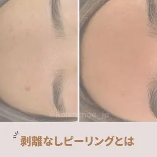 肌質改善 KALANCHOEのエステ・リラクイメージ