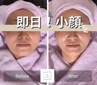 salon de perfection所属・大岩 琴音のエステ・リラクイメージ