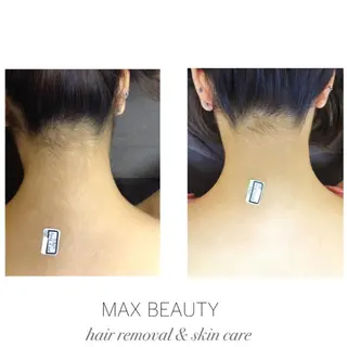 痩身/美肌/脱毛 MAX BEAUTYのエステ・リラクイメージ