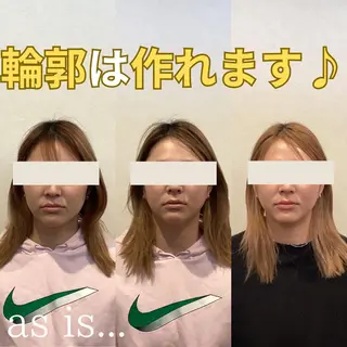 小顔専門アズイズ ビューティー　草津店のエステ・リラクイメージ