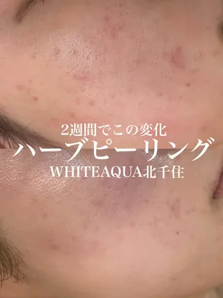 WHITE AQUA 北千住店のエステ・リラクイメージ