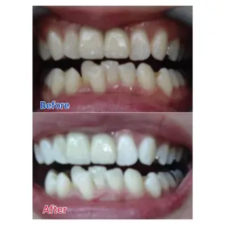 MBEAUTYSALON 千葉店・京成大久保所属・Melty 輝のその他イメージ