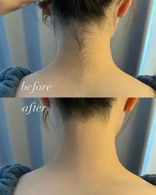 うなじ脱毛/美肌脱毛 LABELのエステ・リラクイメージ