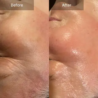 Mandarin Orange所属・毛穴から始める肌メン テマンダリンオレンジのエステ・リラクイメージ