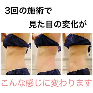 通うほど変わる本格 エステ心斎橋REVIのエステ・リラクイメージ