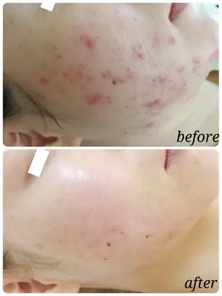 リンパケアサロン 🧡Relairのエステ・リラクイメージ