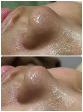 脱毛&フェイシャル 専門店muro.のエステ・リラクイメージ