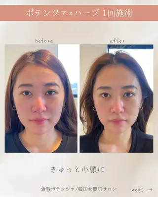 Unfil ｜ちひろのエステ・リラクイメージ