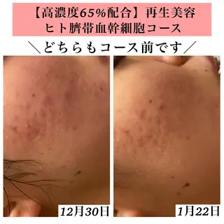 Bellesthe (ベルエステ)のエステ・リラクイメージ