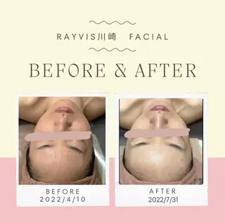 🌿小顔・痩身・脱毛 レイビス川崎店🌿のエステ・リラクイメージ