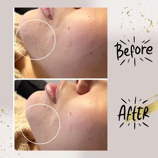 ピーリング専門店 Belluteのエステ・リラクイメージ