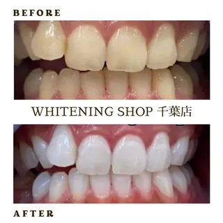 メンズ ホワイトニング ショップ千葉店のその他イメージ