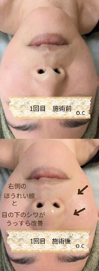 プライベートサロン宿り木所属・江坂@宿り木 脱毛& 耳ツボジュエリーのその他イメージ