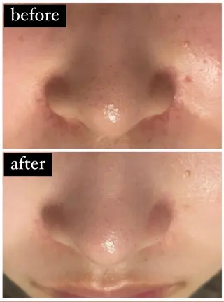 TotalBeautySalon UNCHEL所属・Ito ayakaのその他イメージ