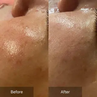 Mandarin Orange所属・毛穴から始める肌メン テマンダリンオレンジのエステ・リラクイメージ