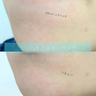 メンズ salonLADYSTYLE所属・稲嶺 美華のエステ・リラクイメージ