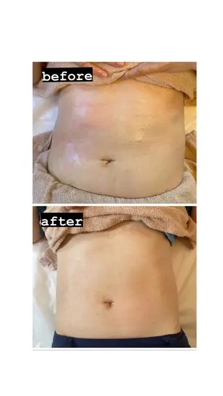 脱毛・エステサロン LuLuNのエステ・リラクイメージ