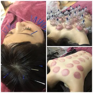 美容鍼灸女性専用 りんご鍼灸治療院のその他イメージ