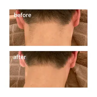 メンズ 都度払い脱毛⭐️ 脱毛サロンMIRACのエステ・リラクイメージ