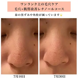 Bellesthe (ベルエステ)のエステ・リラクイメージ