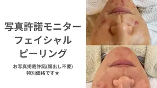 肌質改善 KALANCHOEのエステ・リラクイメージ