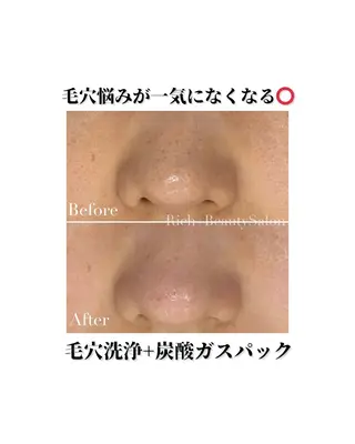 Rich+ ビューティーサロンのエステ・リラクイメージ