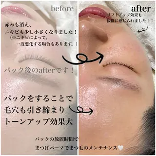 Lashone所属・Lash  One 四条店のエステ・リラクイメージ