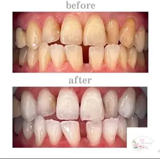 ホワイトニングショップ本厚木所属・ホワイトニング ショップ本厚木のその他イメージ