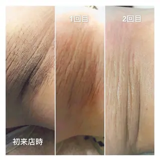 Sugaring / HILOT TAOのエステ・リラクイメージ