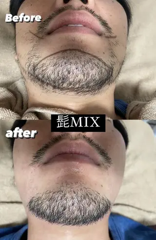 メンズ Epina 千葉店 【エピナ】のエステ・リラクイメージ